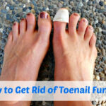 How to Get Rid of Toenail Fungus-f0cebf5a